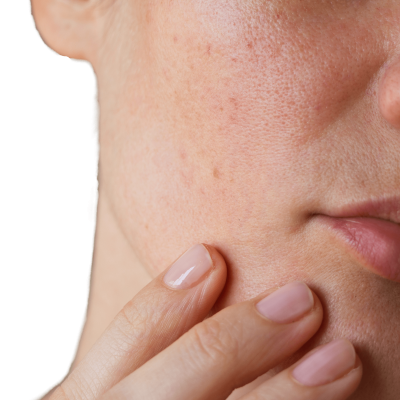 Thalassa - Spots on the Skin