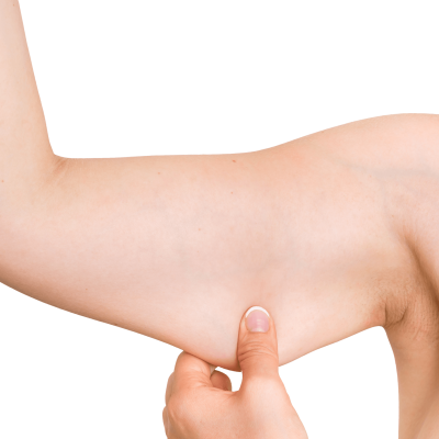 Thalassa - Body sagging